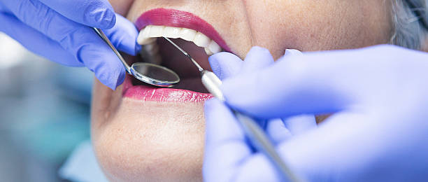 Best Emergency Broken Tooth Repair in Santa Rosa, NM